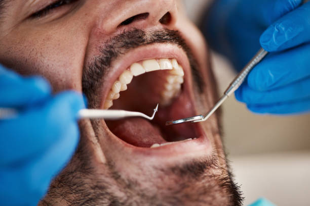 Best Teeth Whitening  in Roosevelt Gardens, FL